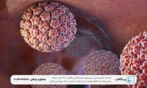 مشکلات جدی در صورت عدم درمان HPV به همراه درمان قطعی